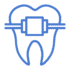 Blue outline of a tooth with a rectangular orthodontic bracket and two horizontal wires, symbolizing dental braces, on a light background.