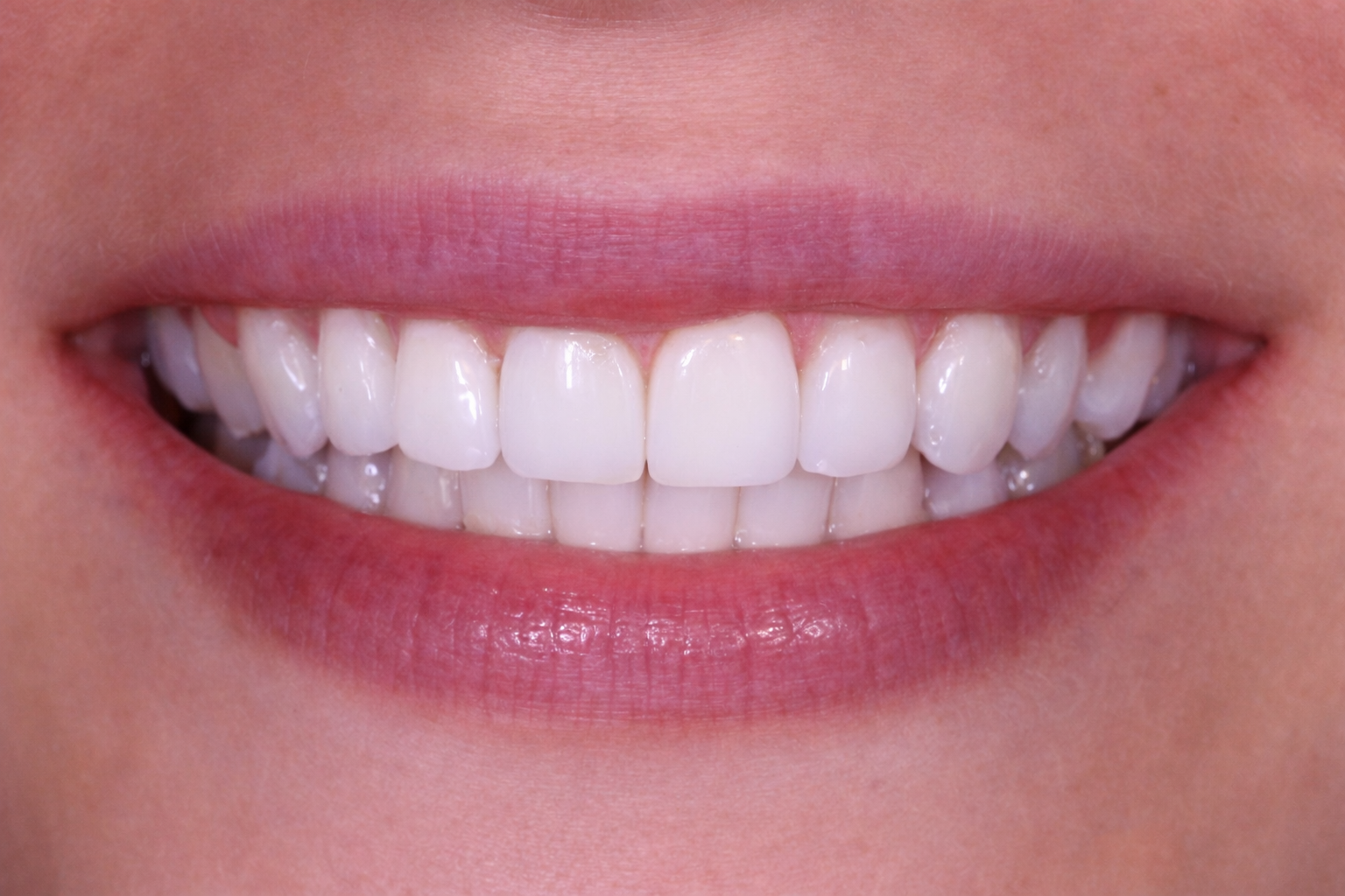 A close-up of a person’s mouth, featured in our smile gallery, shows straight, white teeth and healthy pink lips, smiling directly at the camera.