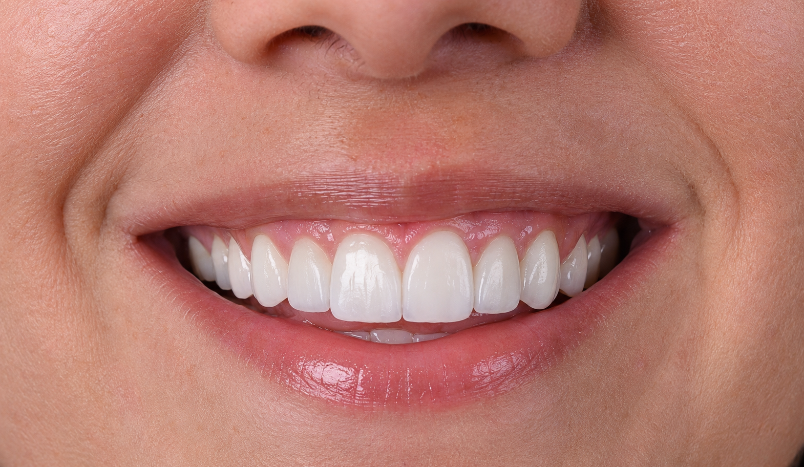 Illustrative after dental treatment example