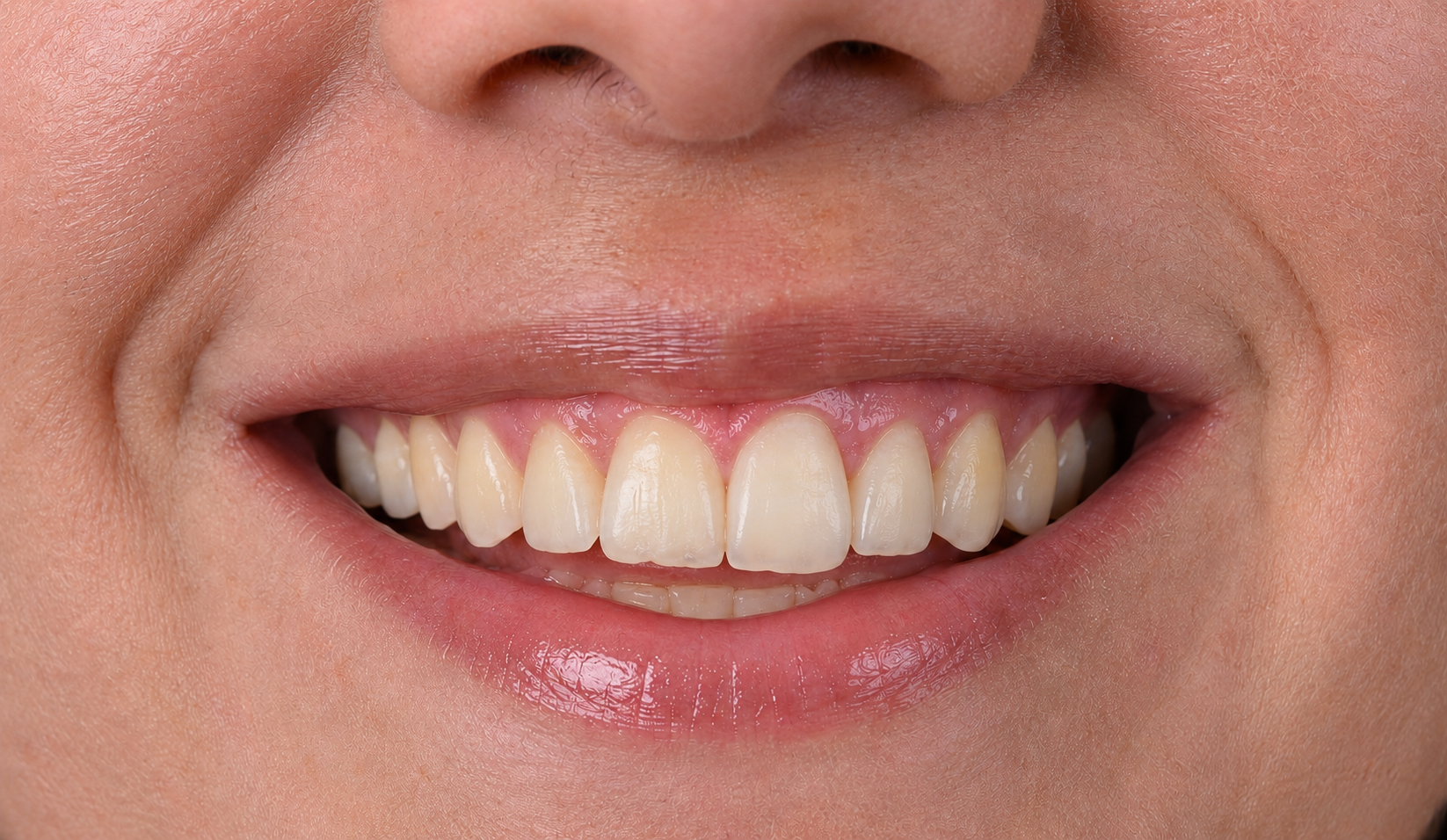 Illustrative before dental treatment example